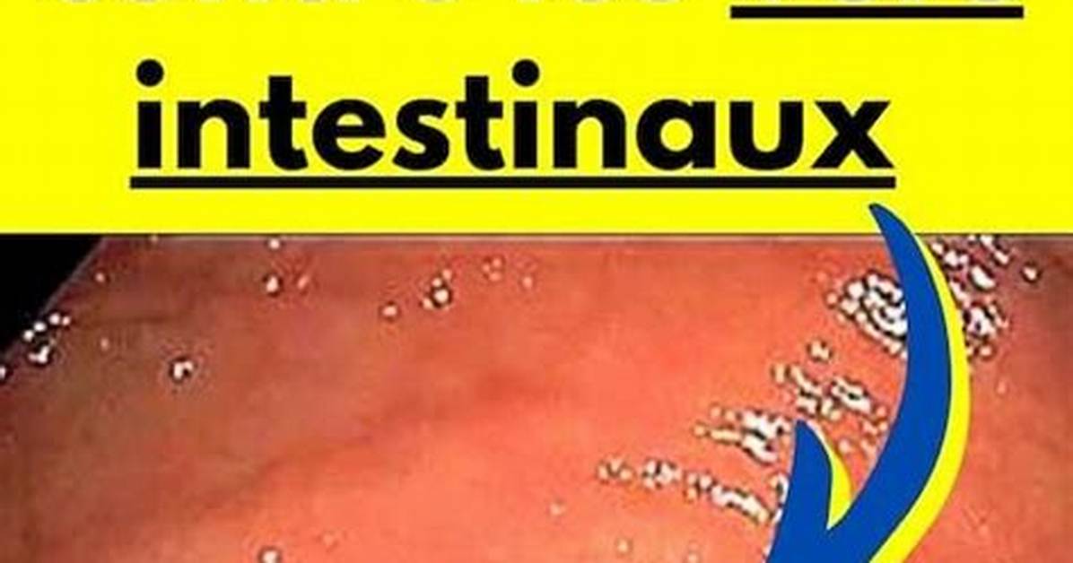 Comment %C3%89Viter Les Vers Dans Les Fruits 300. Jpg