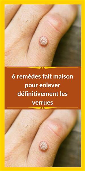 Comment Enlever Une Verrue Avec Une Pomme De Terre?