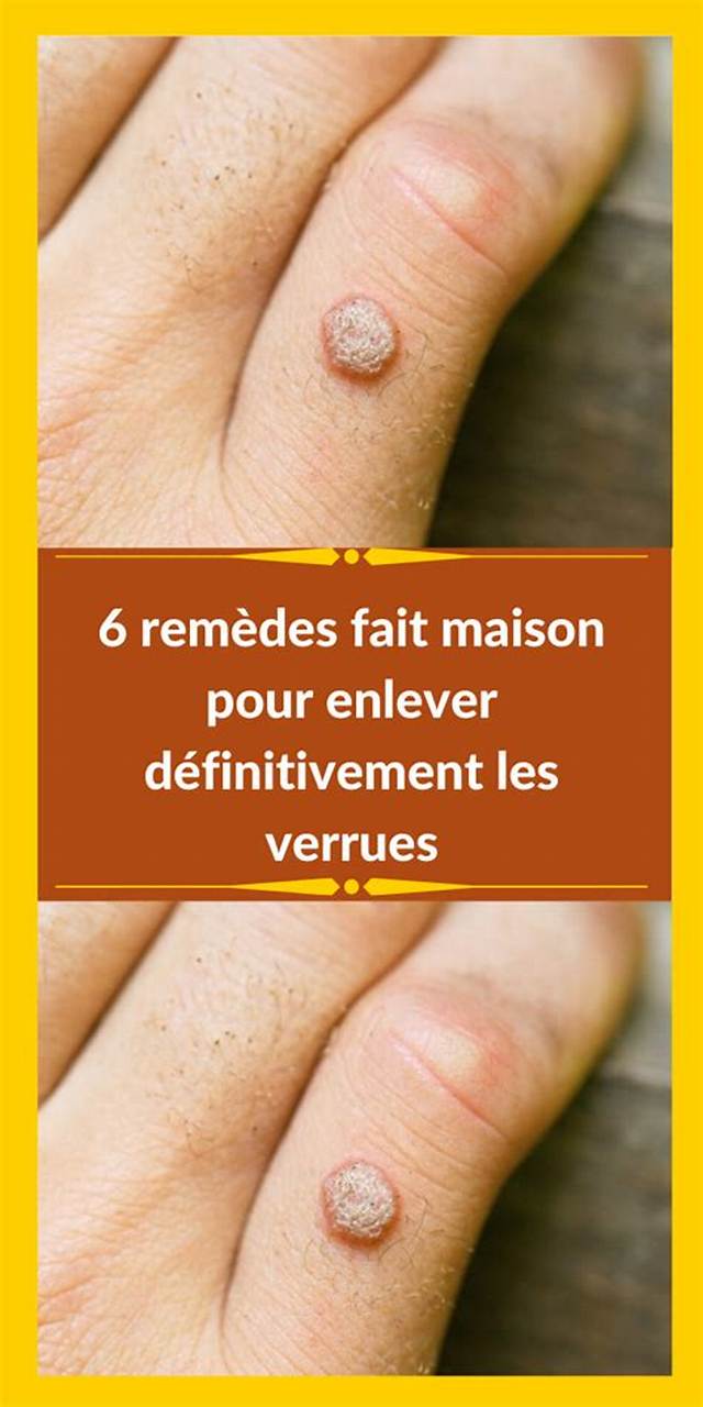 Comment Enlever Une Verrue Avec Une Pomme De Terre?