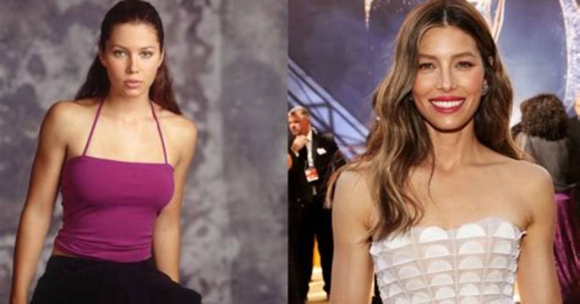 Jessica Biel’s Plastic Surgery: Has the Sinner Star Had a Nose Job and Lip Fillers? Check out the Before and After Pictures!