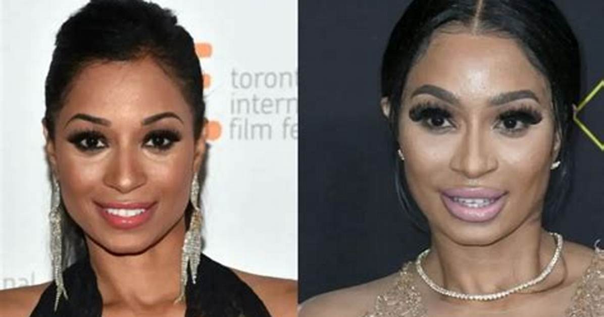 Karlie Redd Before Plastic Surgery Pics: She Denied Her Surgery News