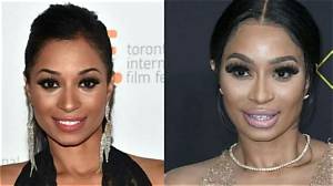 Karlie Redd Before Plastic Surgery Pics: She Denied Her Surgery News