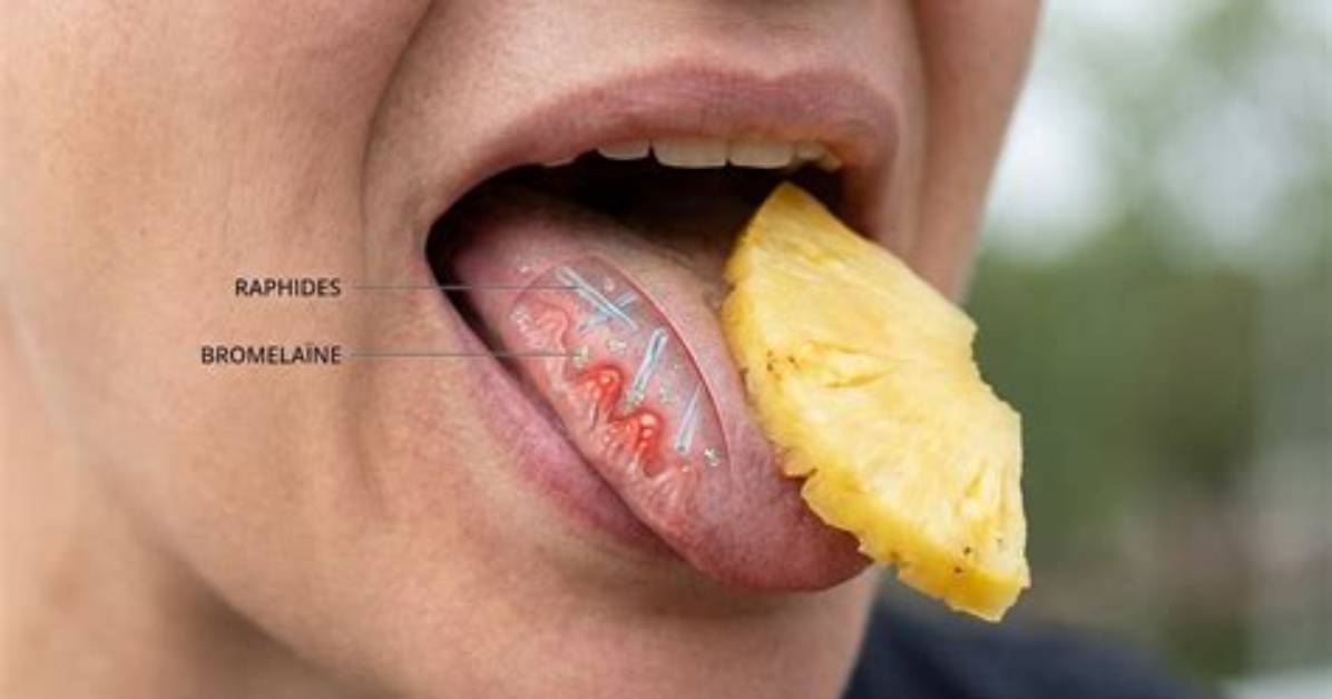 Langue Qui Pique Quand Je Mange Des Fruits?