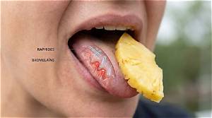 Langue Qui Pique Quand Je Mange Des Fruits?