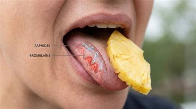 Langue Qui Pique Quand Je Mange Des Fruits?