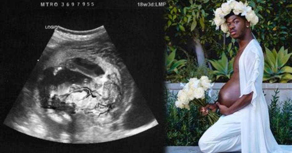 Lil Nas X Flaunts 'Pregnancy Bump' While Posing at His Baby Shower