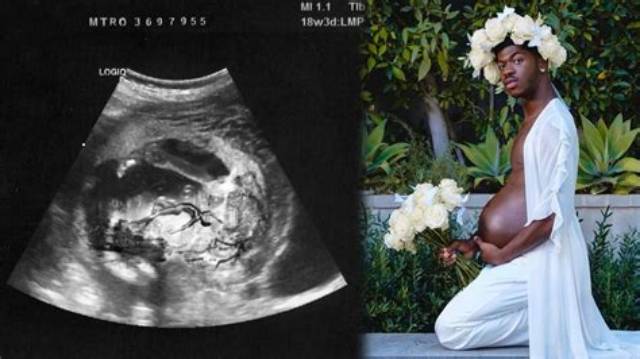 Lil Nas X Flaunts 'Pregnancy Bump' While Posing at His Baby Shower