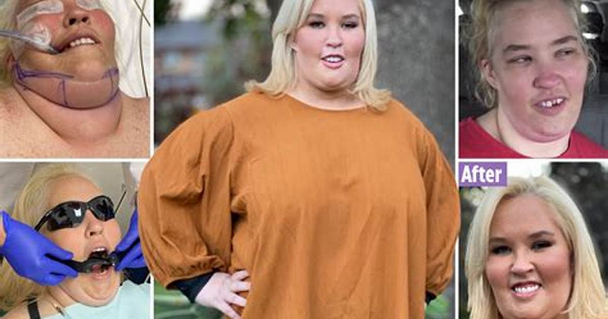 Mama June Unveils New Plastic Surgery Makeover: See Photos