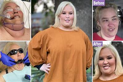 Mama June Unveils New Plastic Surgery Makeover: See Photos