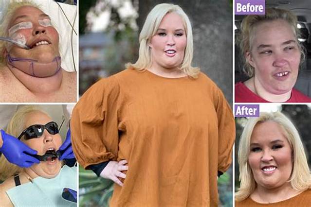 Mama June Unveils New Plastic Surgery Makeover: See Photos