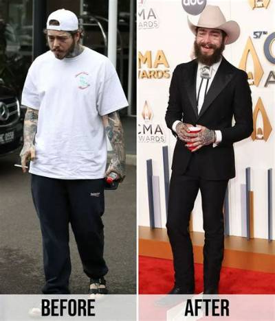 Post Malone Weight Loss: What’s the Story Behind His New Image?