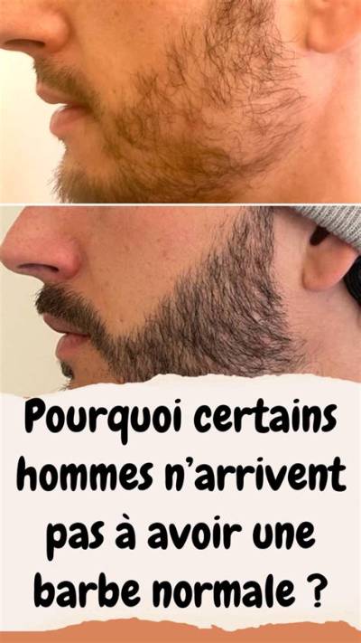 Pourquoi Certains Hommes N’ont Pas De Pomme D’adam?