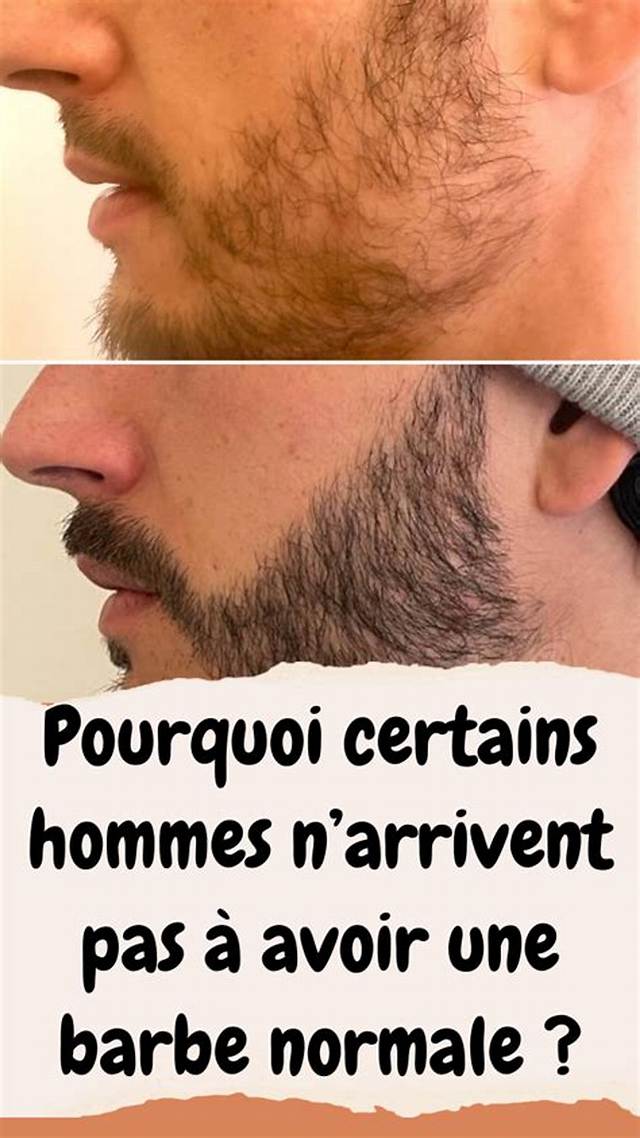 Pourquoi Certains Hommes N’ont Pas De Pomme D’adam?