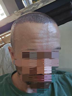 Removing Hair Except for Top Bit? That's Cutting Crossword Clue Puzzle Answer with 5 Letters