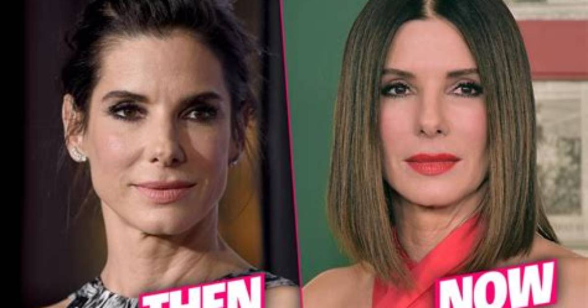 Sandra Bullock Plastic Surgery — Experts Weigh in on Her Botox
