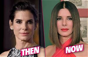 Sandra Bullock Plastic Surgery — Experts Weigh in on Her Botox