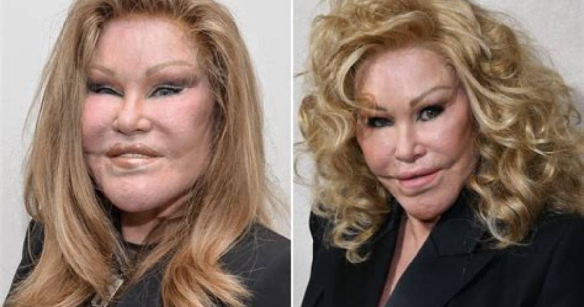 Socialite Jocelyn Wildenstein Before Surgery: Botched Transformation Gone Wrong Photos