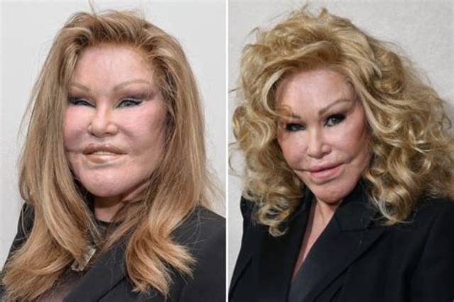 Socialite Jocelyn Wildenstein Before Surgery: Botched Transformation Gone Wrong Photos