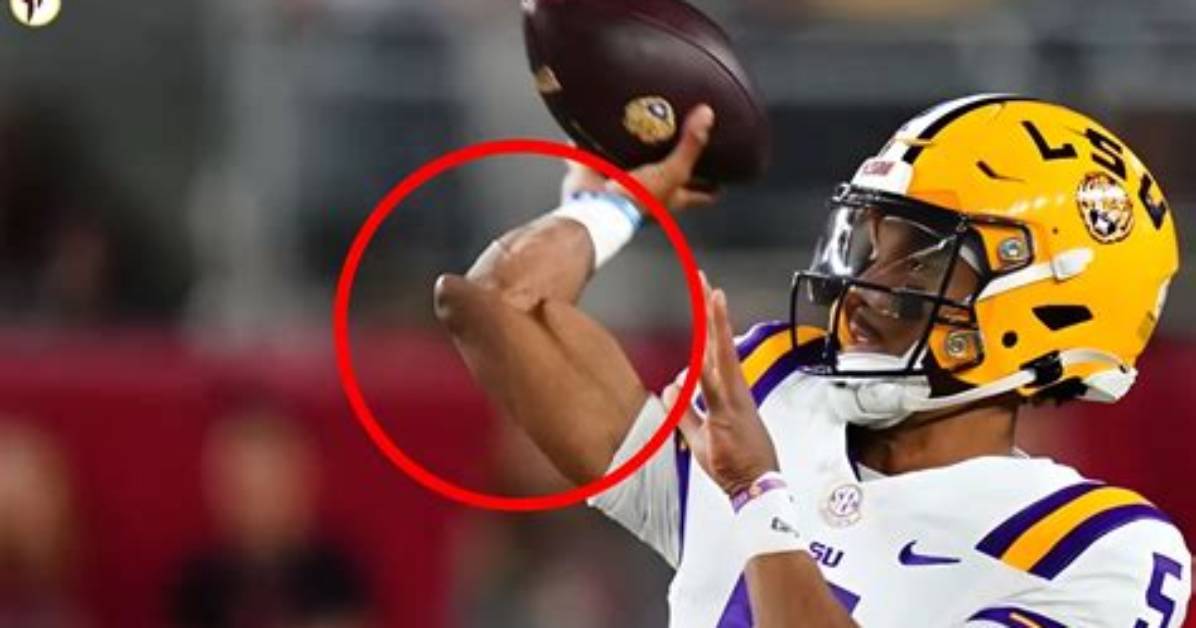 What Happened to James Merritt Arm? Injury and Surgery Update – Pastor Health Condition Explained