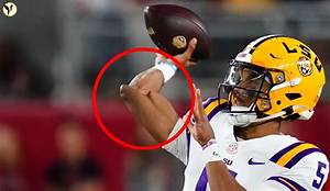 What Happened to James Merritt Arm? Injury and Surgery Update – Pastor Health Condition Explained