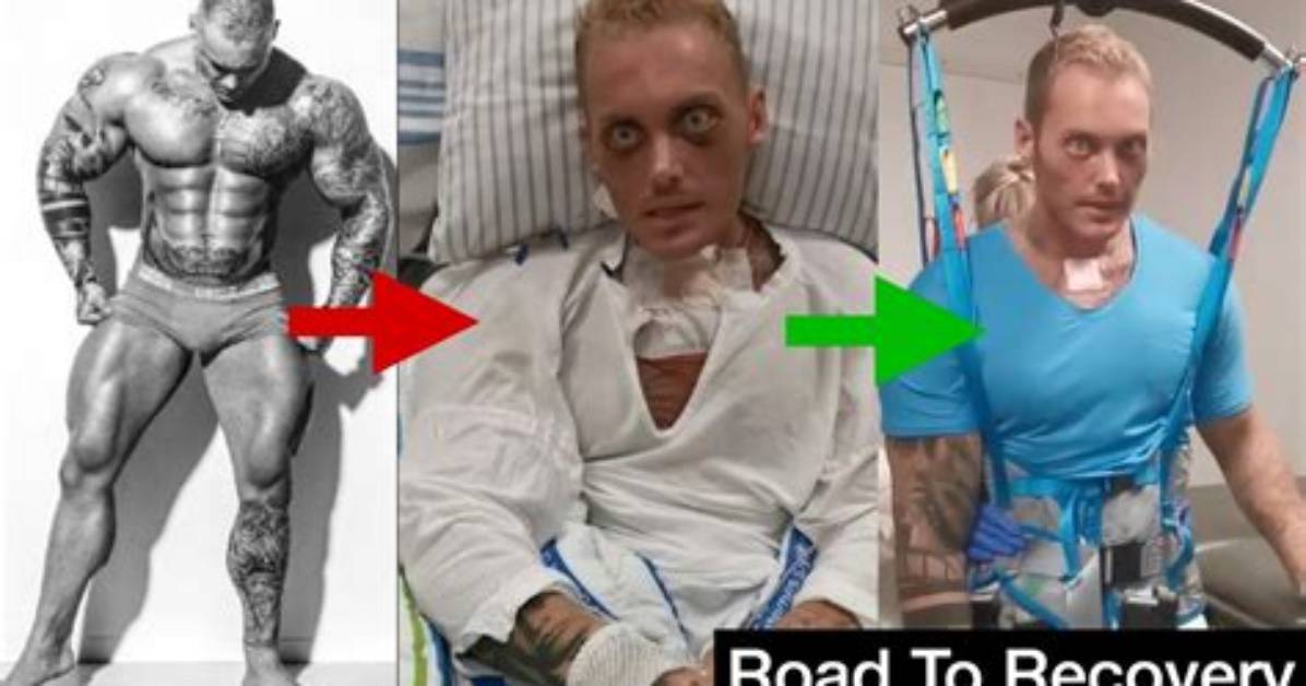 What Happened to Patrick Teichert? Bodybuilder Was in Coma After Accident, Full Story