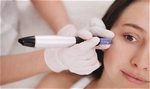 What I Wish I Knew About Microneedling Before Trying It