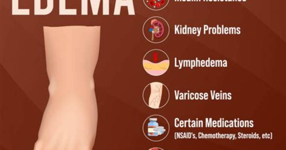 What Is the Main Causes of Edema?