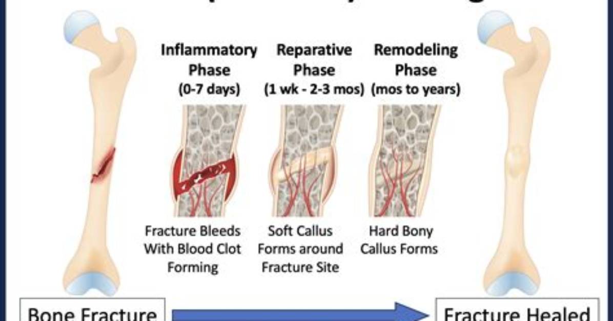 Why Do Bone Injuries Heal Much More Rapidly Than Injuries to Cartilage?