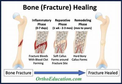 Why Do Bone Injuries Heal Much More Rapidly Than Injuries to Cartilage?