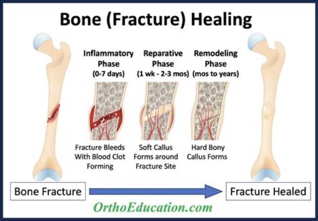 Why Do Bone Injuries Heal Much More Rapidly Than Injuries to Cartilage?