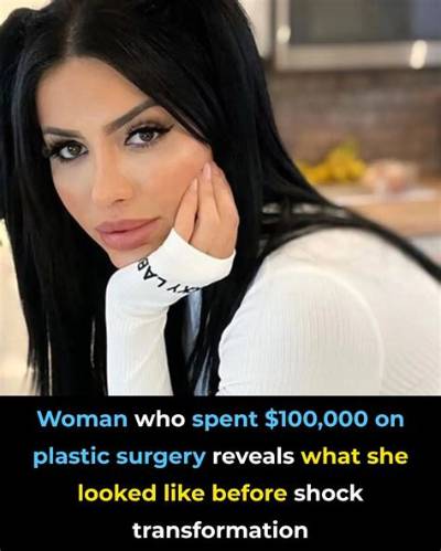 Woman Who Spent £130,000 on Surgery to Go from 5’6” to 6” Explains Why She Regrets It